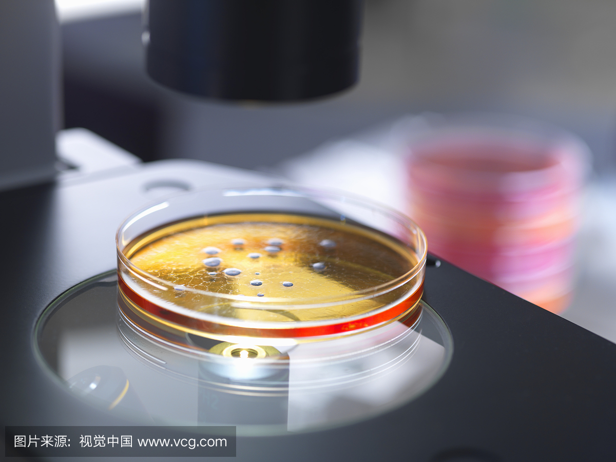 含有细菌培养的培养皿在微生物实验室用倒置光