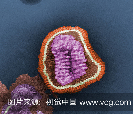 负染色透射电子显微镜(TEM)描绘了流感病毒颗