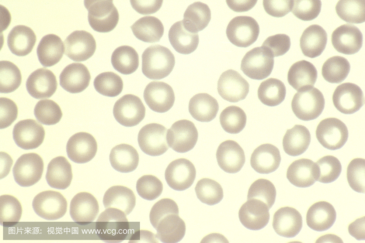 正常人红细胞或红细胞在外周血涂片中,Wright