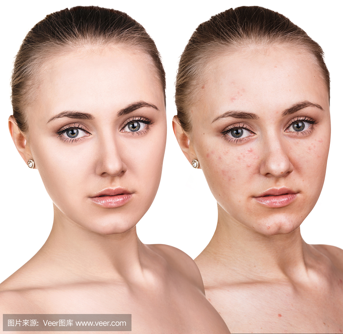 女人脸上有问题的皮肤