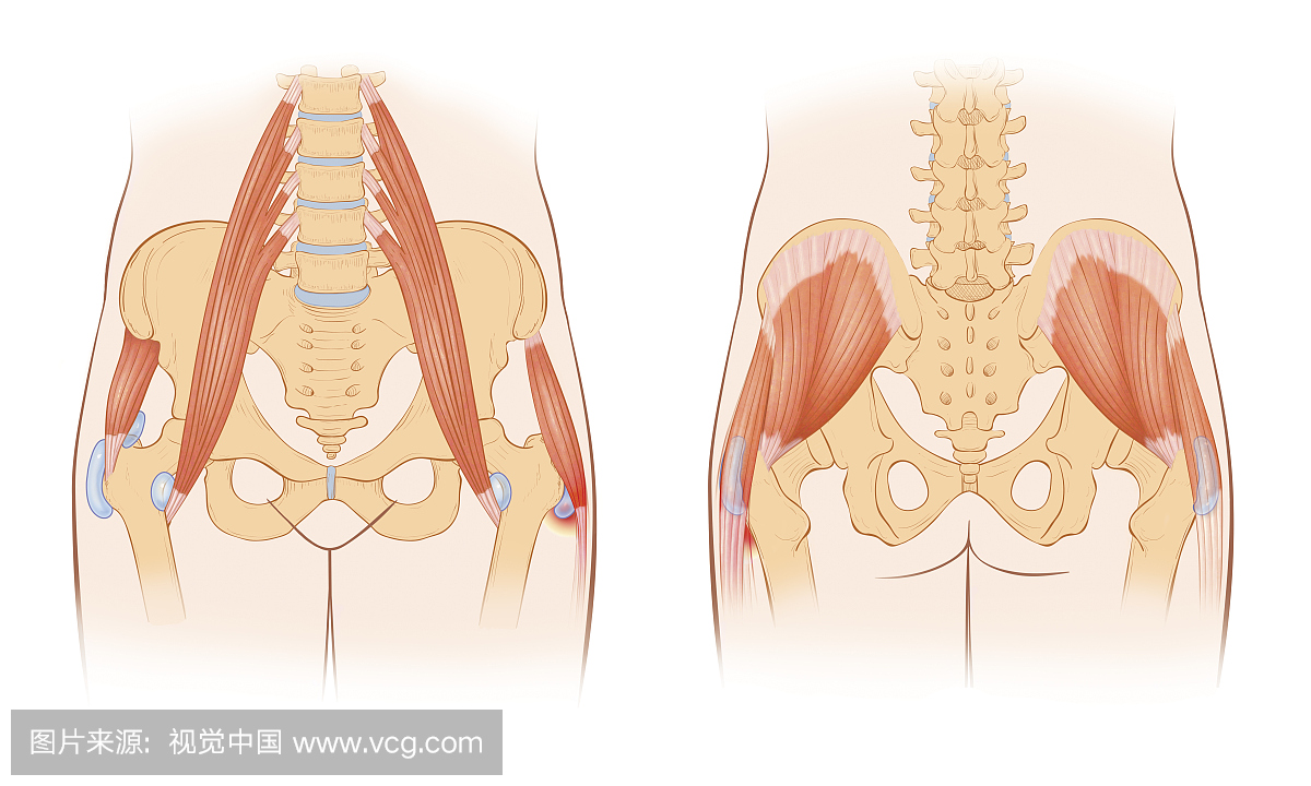 白色背景,髂骨,髂腰肌,肌腱