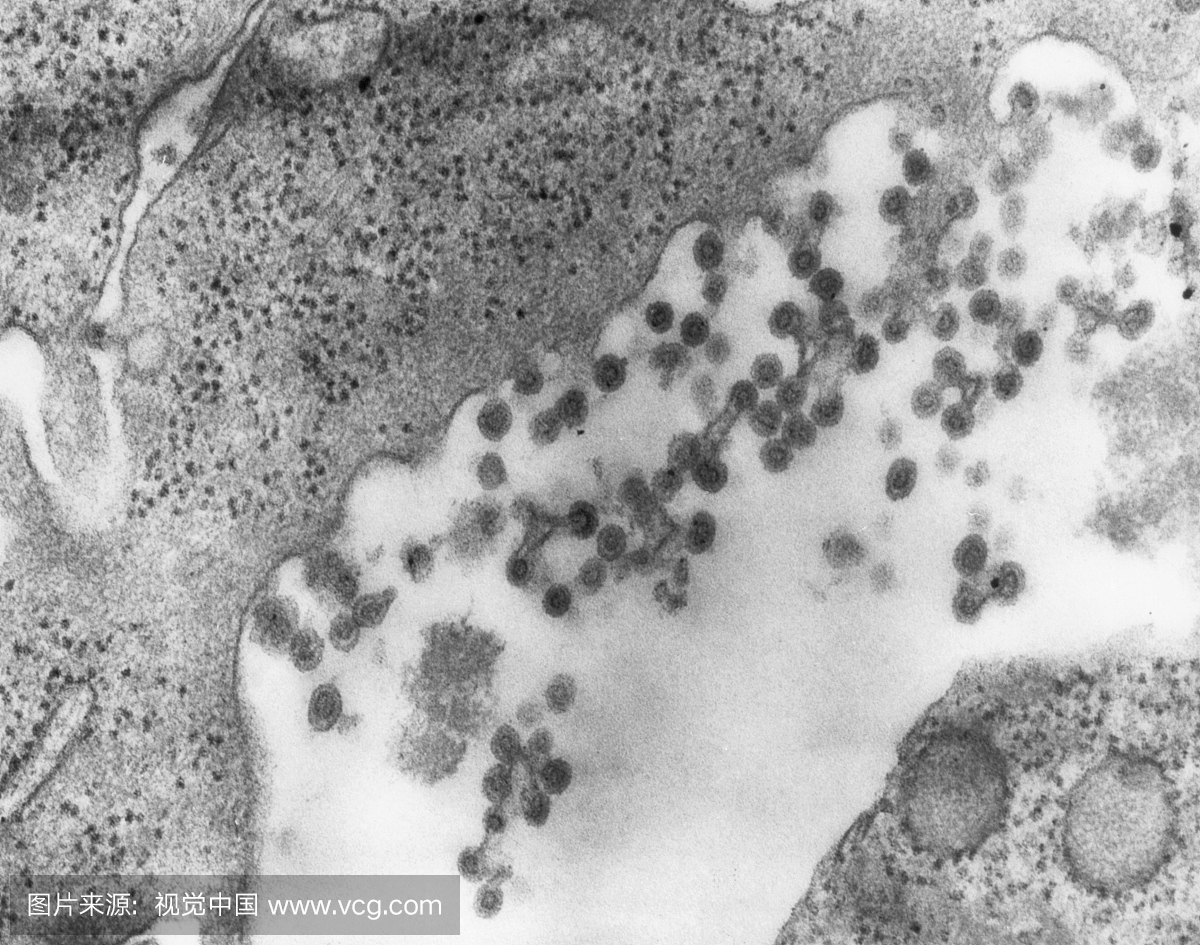 风疹病毒的传播电子显微照片,俗称德国麻疹。