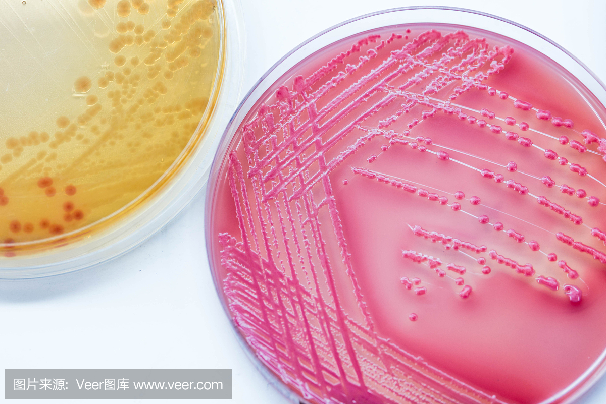 细菌在固体培养基上的生长现象 细菌固体培养基