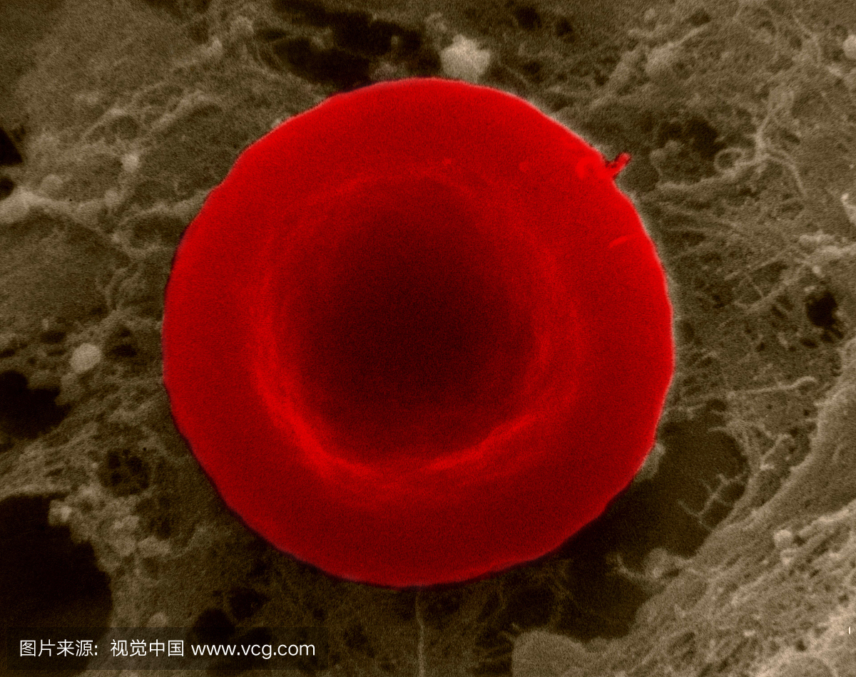 正常红细胞在等渗溶液中扫描电子显微镜照片显