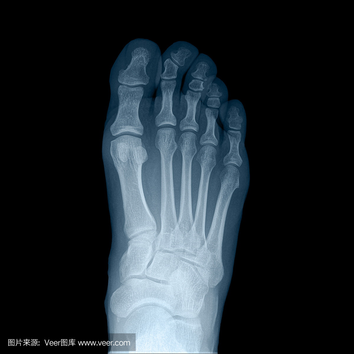 x射线人的右脚 - 顶视图