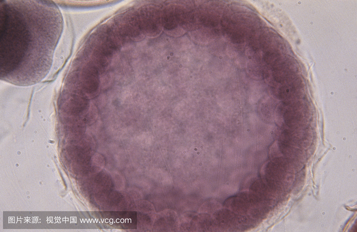 海星胚胎学,囊胚期。 LM X400。