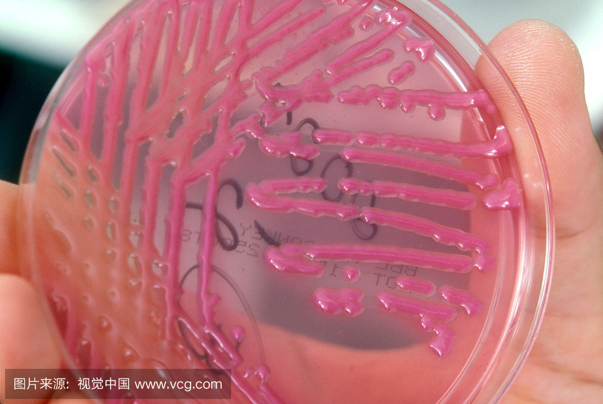 肺炎克雷伯杆菌细菌培养,取自痰样品。