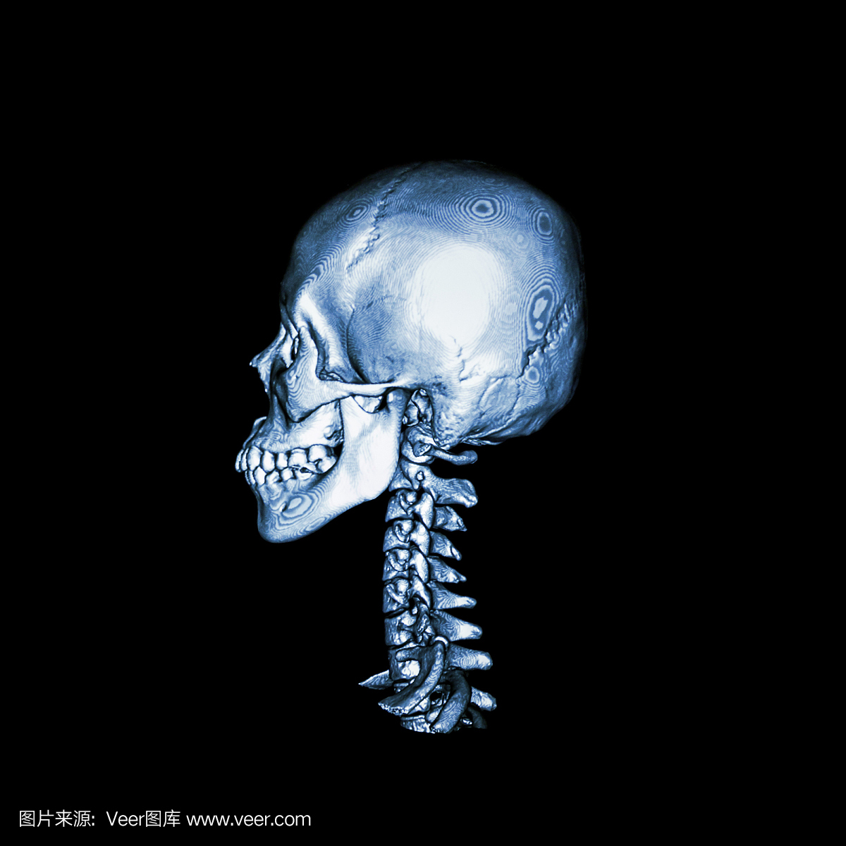 CT扫描与正常人类头骨和颈椎的3D图像。侧视