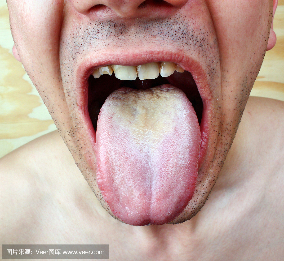 感染舌头
