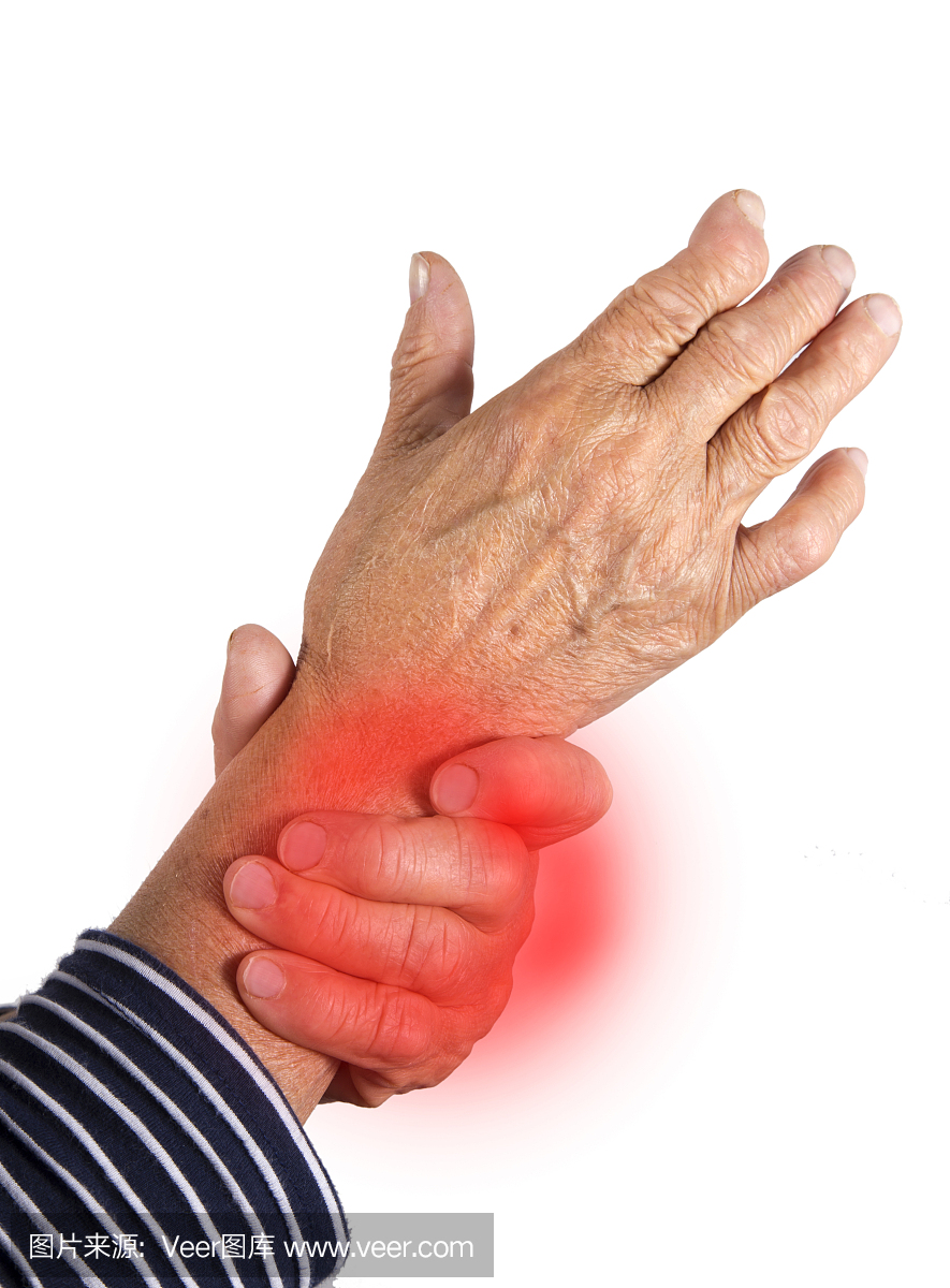 手变形类风湿关节炎