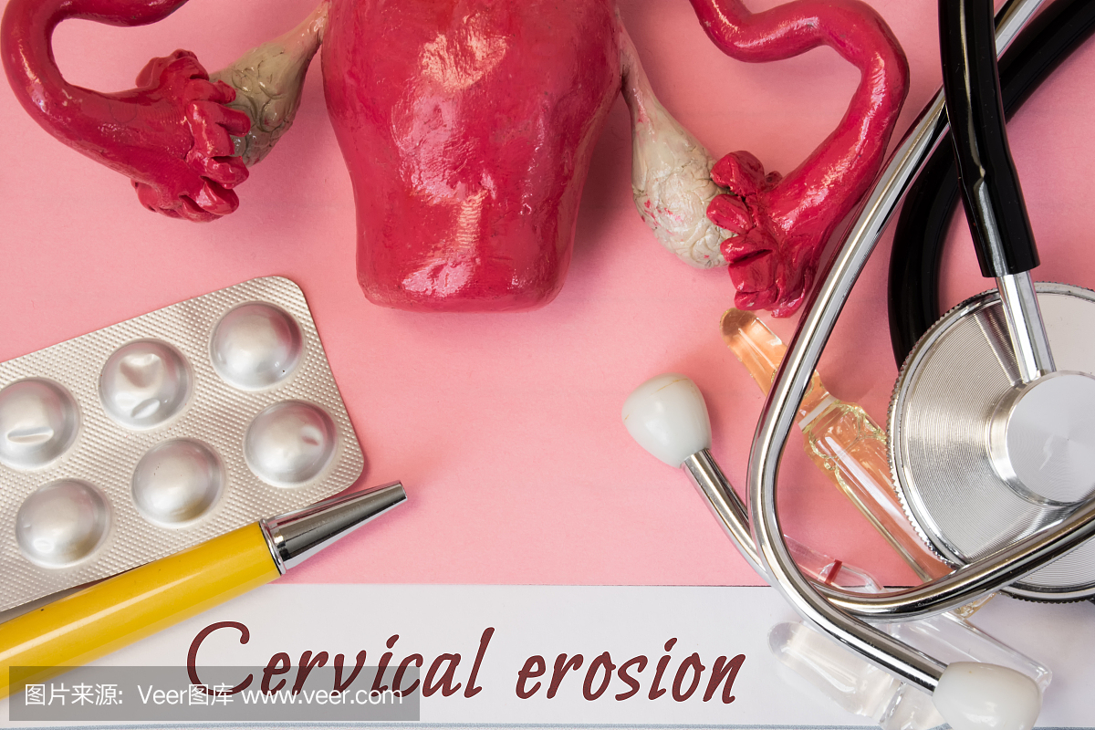 宫颈管,宫颈癌,宫颈腺癌,子宫颈