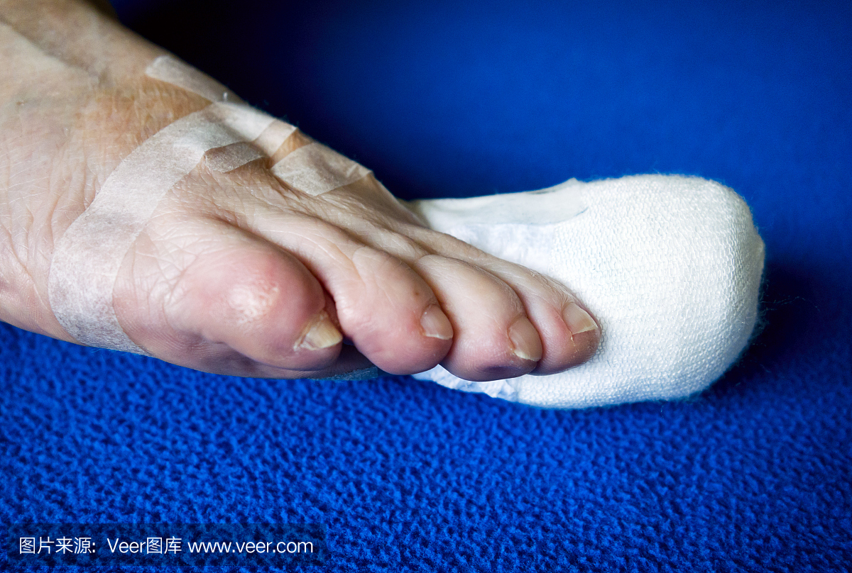 人类脚趾,脚指缝,脚趾,趾头