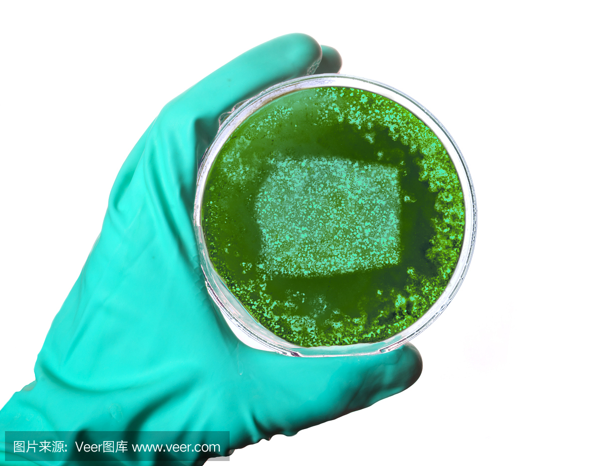 赤道几内亚,赤道基内亚,皮氏培养皿,琼脂