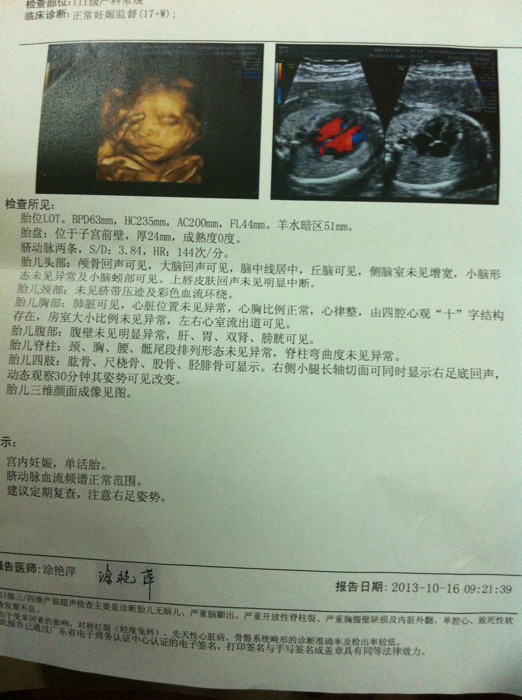 医生,你好,四维彩超检查 胎儿颈部皱褶nf增厚0.9cm,孕
