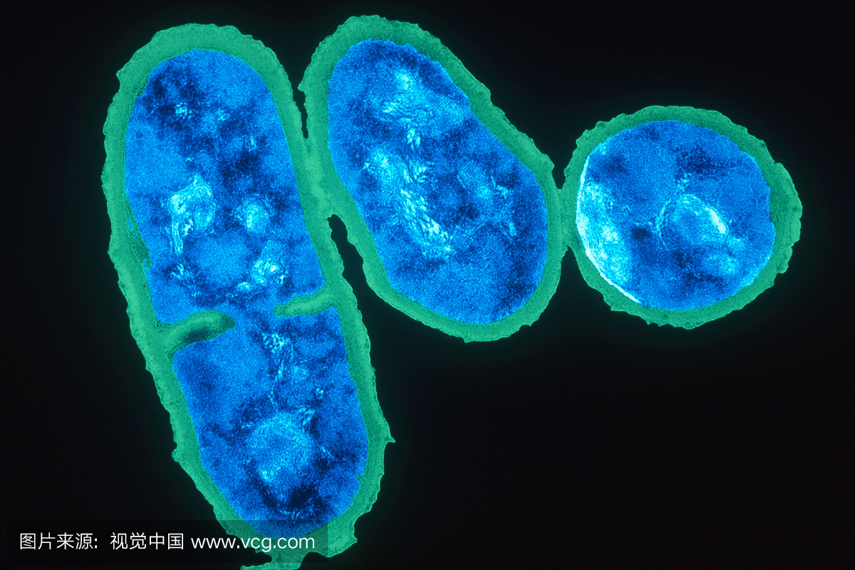 痤疮丙酸杆菌的颜色增强型TEM(透射电子显微