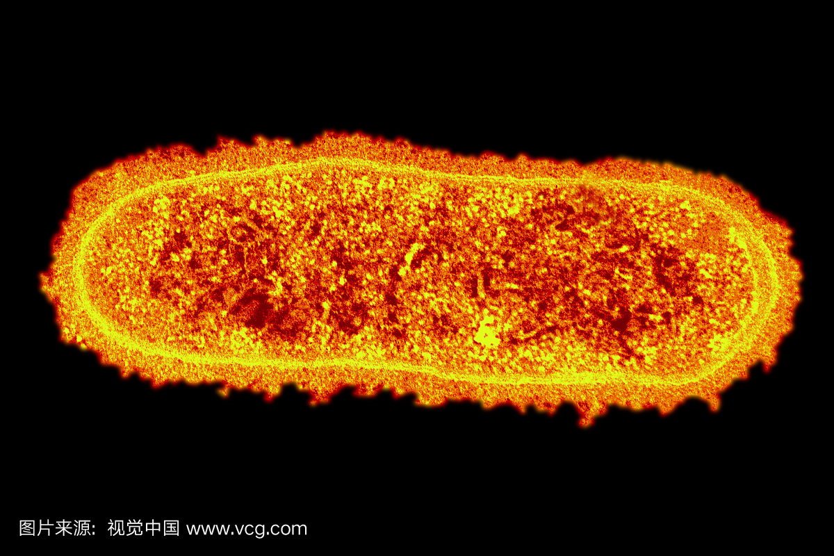 大肠杆菌细菌是正常的,通常在体内是有益的细