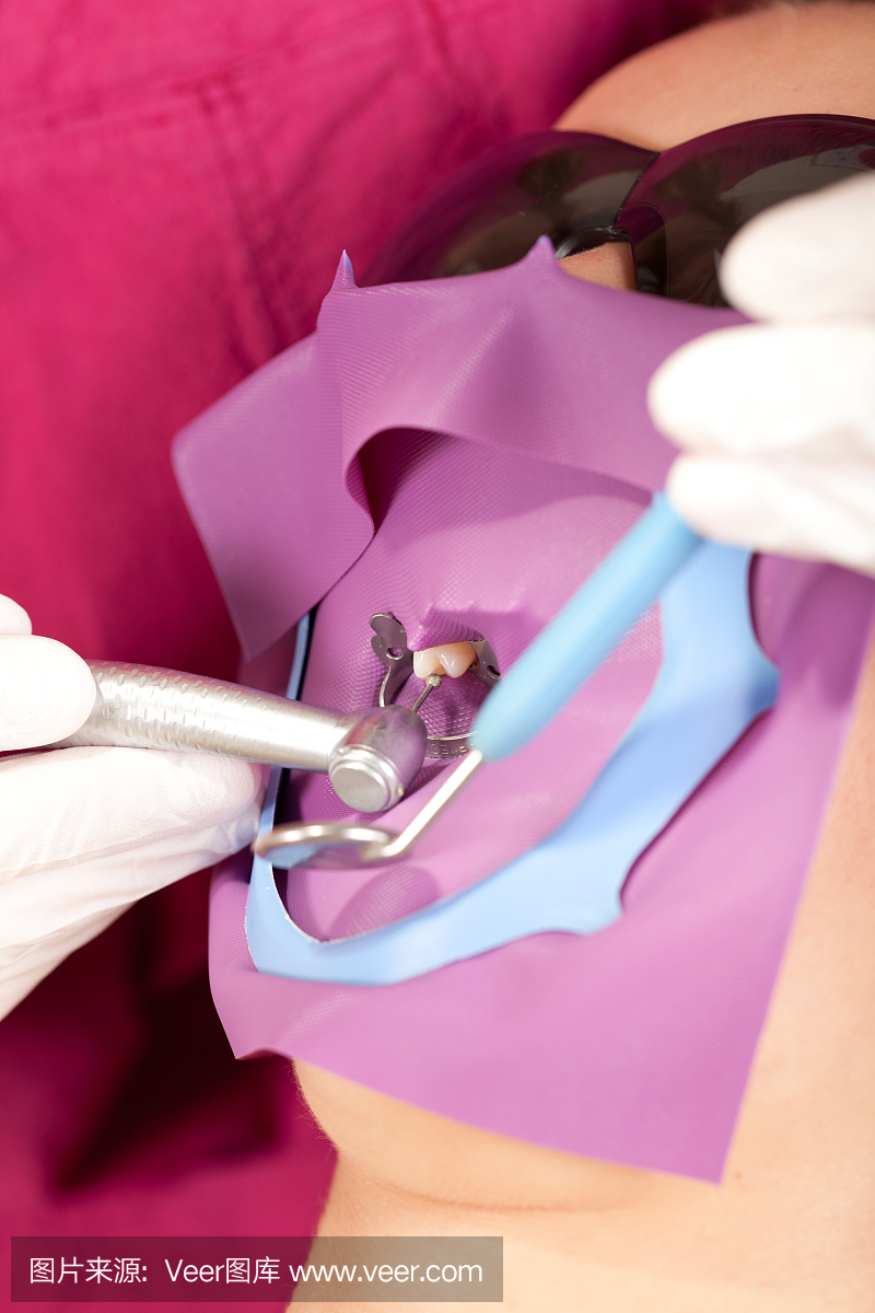 牙科橡皮障,牙科用橡皮布,齿科橡皮障,折角镜