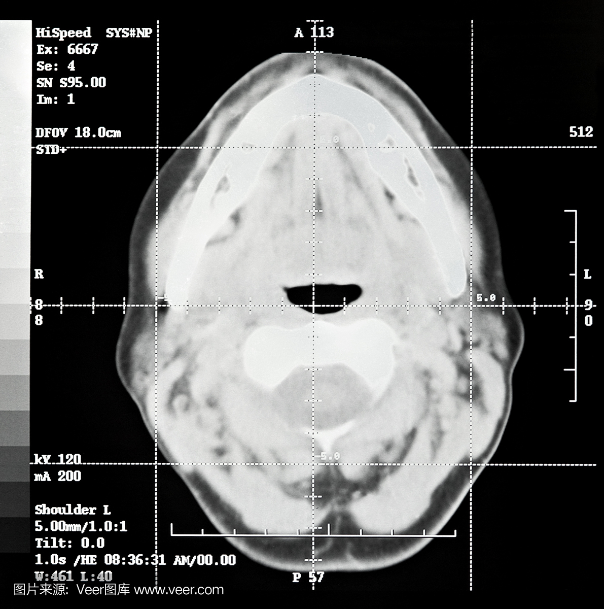 脑CT切片