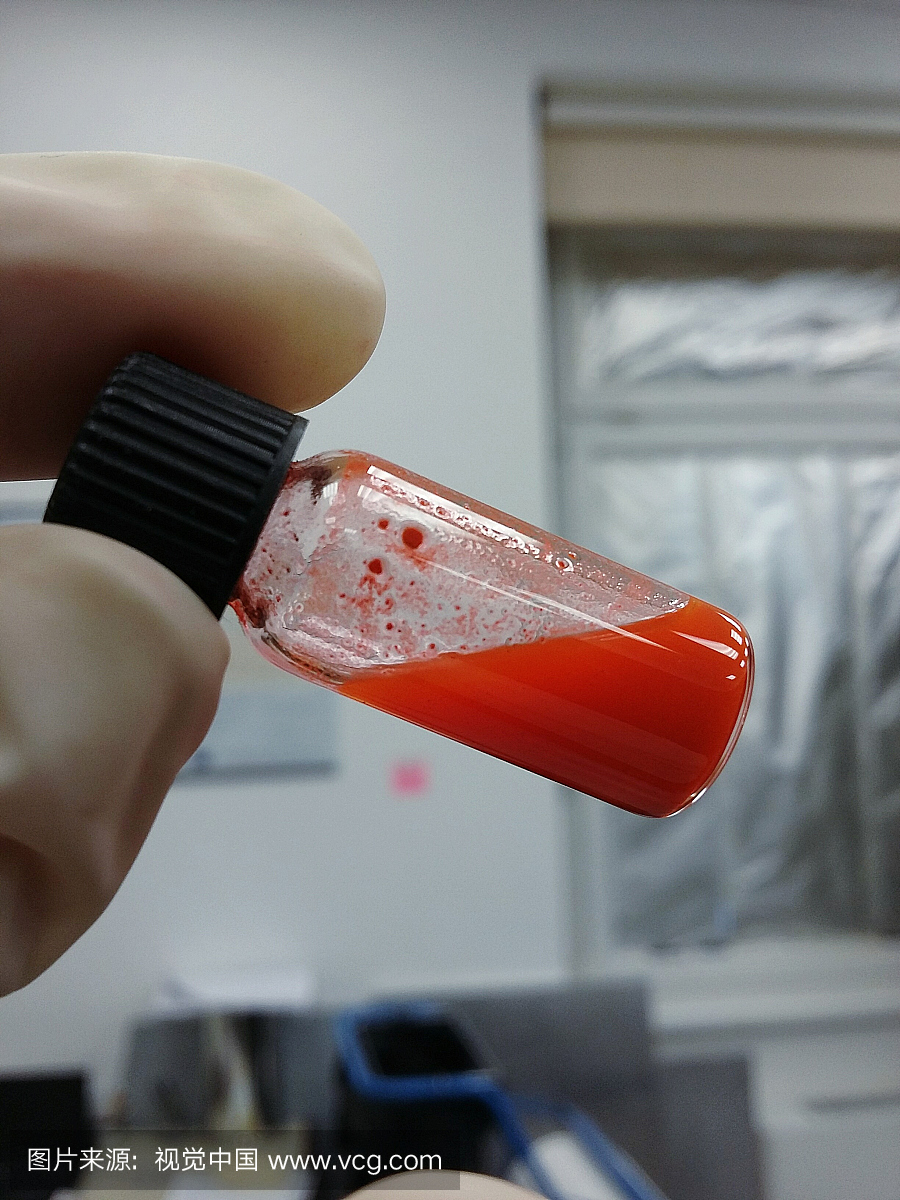 在实验室拿着红色液体瓶的人的手