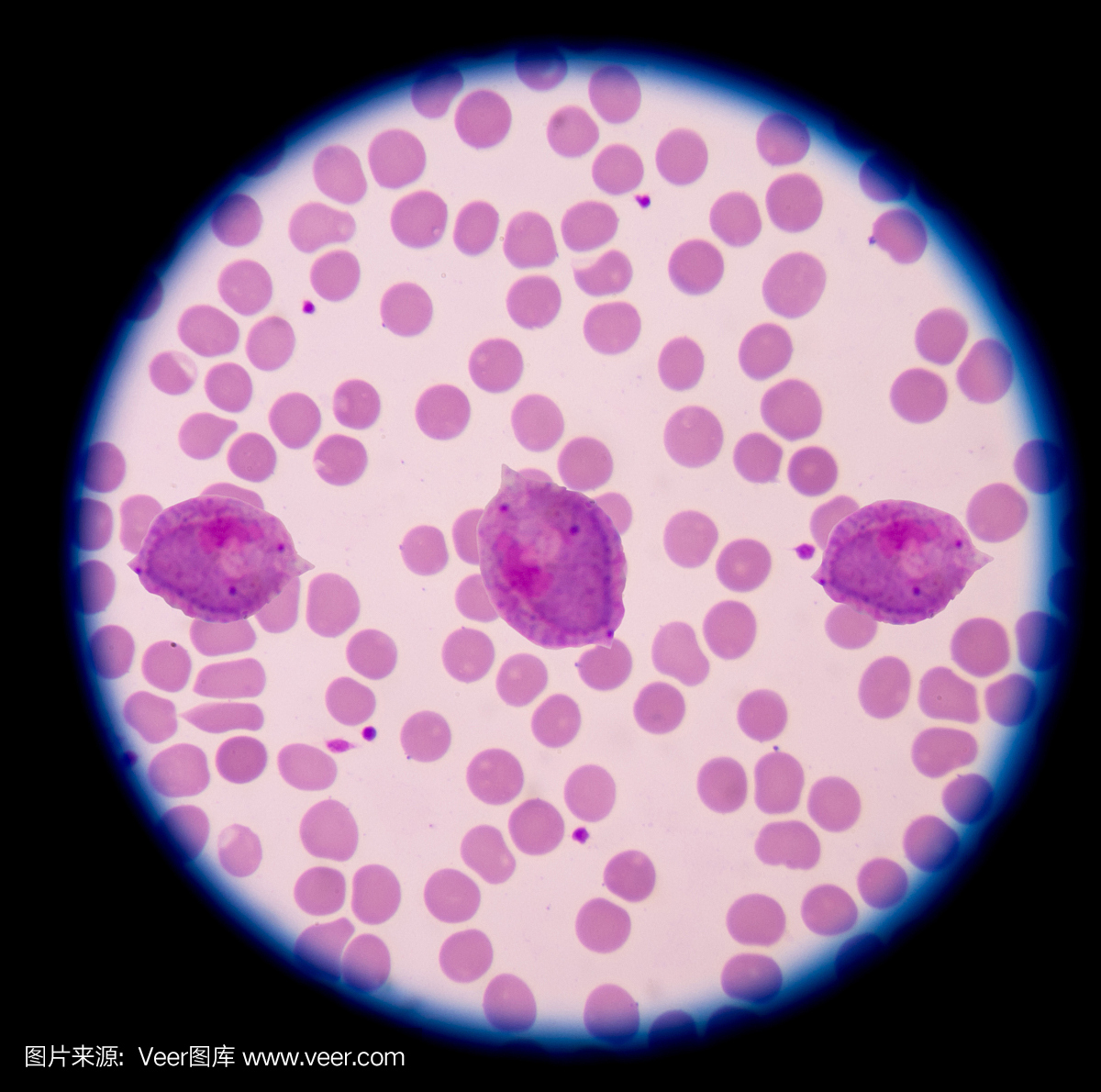 疟疾血液涂片图片